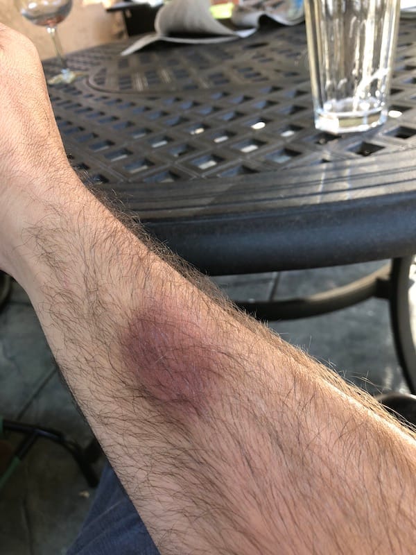 24 hours after a long seminar on more knife defensive work.